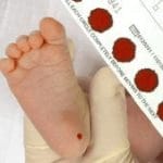 غربالگری نوزاد در منزل